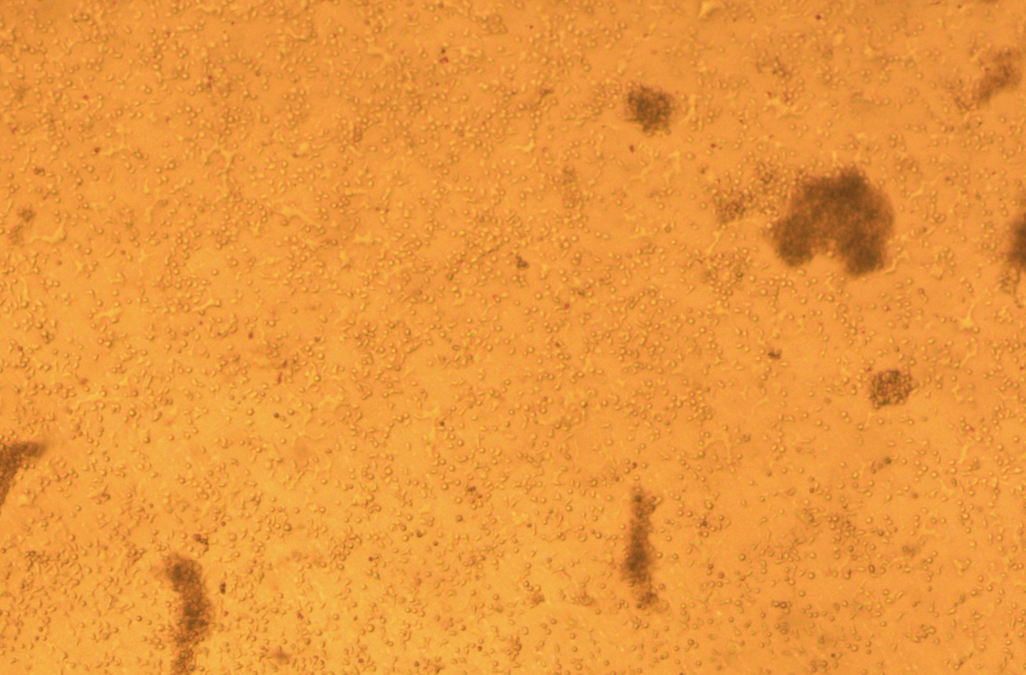 1644974016557197.jpg 2021外周血.jpg