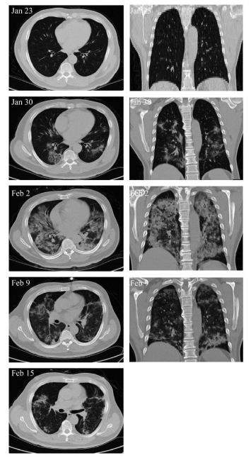 1670376058678663.png 微信圖片_20221207091950.png